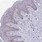 Exosome Component 7 antibody, HPA057980, Atlas Antibodies, Immunohistochemistry paraffin image 