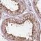 DNA-directed RNA polymerase III subunit RPC6 antibody, NBP2-47328, Novus Biologicals, Immunohistochemistry frozen image 