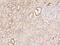 Poly(RC) Binding Protein 4 antibody, 207608-T08, Sino Biological, Immunohistochemistry paraffin image 