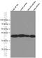 NFKB Inhibitor Alpha antibody, 66418-1-Ig, Proteintech Group, Western Blot image 