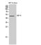 Growth Differentiation Factor 6 antibody, STJ97348, St John