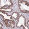 NADH:Ubiquinone Oxidoreductase Subunit B6 antibody, NBP1-92172, Novus Biologicals, Immunohistochemistry frozen image 