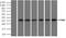 Pim-2 Proto-Oncogene, Serine/Threonine Kinase antibody, NBP2-02441, Novus Biologicals, Immunoprecipitation image 