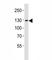 Janus Kinase 2 antibody, F52643-0.4ML, NSJ Bioreagents, Western Blot image 