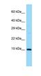 Small Ubiquitin Like Modifier 3 antibody, orb330452, Biorbyt, Western Blot image 