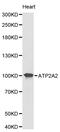 ATPase Sarcoplasmic/Endoplasmic Reticulum Ca2+ Transporting 2 antibody, LS-C192370, Lifespan Biosciences, Western Blot image 