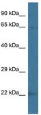 Vacuolar Protein Sorting 45 Homolog antibody, TA340170, Origene, Western Blot image 