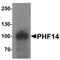 PHD Finger Protein 14 antibody, PA5-72775, Invitrogen Antibodies, Western Blot image 