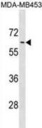 Adrenoceptor Alpha 1B antibody, abx031294, Abbexa, Western Blot image 