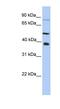 Methyltransferase Like 2B antibody, NBP1-55020, Novus Biologicals, Western Blot image 