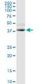 G Protein-Coupled Receptor Class C Group 5 Member D antibody, H00055507-M01, Novus Biologicals, Western Blot image 