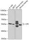 Carboxypeptidase E antibody, 19-677, ProSci, Western Blot image 