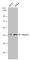 Hepsin antibody, GTX114479, GeneTex, Western Blot image 