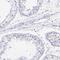 Tryptase Delta 1 antibody, HPA040182, Atlas Antibodies, Immunohistochemistry paraffin image 