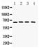 Cryptochrome Circadian Regulator 2 antibody, PB9576, Boster Biological Technology, Western Blot image 