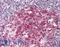 General Transcription Factor IIA Subunit 1 antibody, LS-B9925, Lifespan Biosciences, Immunohistochemistry paraffin image 