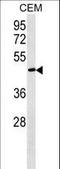 Fibulin 5 antibody, LS-C159626, Lifespan Biosciences, Western Blot image 