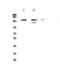 Inositol Polyphosphate-5-Phosphatase D antibody, A03358, Boster Biological Technology, Western Blot image 