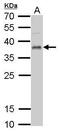 Ubiquitin Recognition Factor In ER Associated Degradation 1 antibody, GTX109579, GeneTex, Western Blot image 