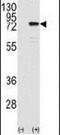 Protein Kinase C Eta antibody, PA5-13746, Invitrogen Antibodies, Western Blot image 