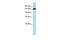 Gse1 Coiled-Coil Protein antibody, GTX45337, GeneTex, Western Blot image 