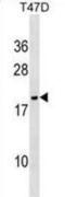 NME/NM23 Nucleoside Diphosphate Kinase 6 antibody, abx033859, Abbexa, Western Blot image 