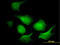 Adenylate Kinase 1 antibody, LS-C196633, Lifespan Biosciences, Immunofluorescence image 