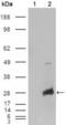 Crystallin Alpha B antibody, MA5-15383, Invitrogen Antibodies, Western Blot image 