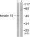 Keratin 15 antibody, abx013119, Abbexa, Western Blot image 