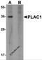 Placenta Enriched 1 antibody, 6015, ProSci, Western Blot image 
