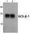 Guanylate Cyclase 1 Soluble Subunit Beta 1 antibody, PA5-75169, Invitrogen Antibodies, Western Blot image 