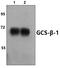 Guanylate Cyclase 1 Soluble Subunit Beta 1 antibody, PA5-75169, Invitrogen Antibodies, Western Blot image 