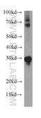 High Mobility Group Box 2 antibody, 15605-1-AP, Proteintech Group, Western Blot image 