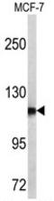Aminopeptidase Puromycin Sensitive antibody, AP17672PU-N, Origene, Western Blot image 