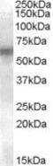 LYN Proto-Oncogene, Src Family Tyrosine Kinase antibody, PA5-18912, Invitrogen Antibodies, Western Blot image 