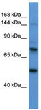 KIAA0634 antibody, TA341927, Origene, Western Blot image 