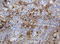 Thymidine Phosphorylase antibody, LS-C175544, Lifespan Biosciences, Immunohistochemistry paraffin image 