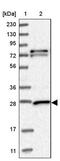 Glutathione S-Transferase Mu 3 antibody, PA5-57191, Invitrogen Antibodies, Western Blot image 
