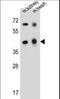 Adenosine Deaminase Like antibody, LS-C156035, Lifespan Biosciences, Western Blot image 