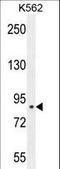 Chloride Intracellular Channel 6 antibody, LS-C168840, Lifespan Biosciences, Western Blot image 