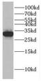 General Transcription Factor IIH Subunit 3 antibody, FNab03714, FineTest, Western Blot image 