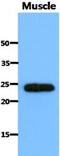 Secretion Associated Ras Related GTPase 1B antibody, MBS200237, MyBioSource, Western Blot image 