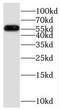 Pyruvate Dehyrogenase Phosphatase Catalytic Subunit 1 antibody, FNab06691, FineTest, Western Blot image 