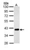 Twinfilin Actin Binding Protein 1 antibody, PA5-29312, Invitrogen Antibodies, Western Blot image 