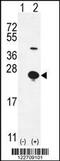 Epithelial Mitogen antibody, 55-730, ProSci, Western Blot image 