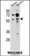 Tripartite Motif Containing 62 antibody, 56-973, ProSci, Western Blot image 