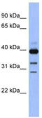 Guanine nucleotide-binding protein G(o) subunit alpha antibody, TA333537, Origene, Western Blot image 