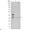 CD1a Molecule antibody, LS-C812526, Lifespan Biosciences, Enzyme Linked Immunosorbent Assay image 