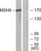 MutS Homolog 6 antibody, LS-C119578, Lifespan Biosciences, Western Blot image 