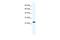 RNA Transcription, Translation And Transport Factor antibody, A07464, Boster Biological Technology, Western Blot image 